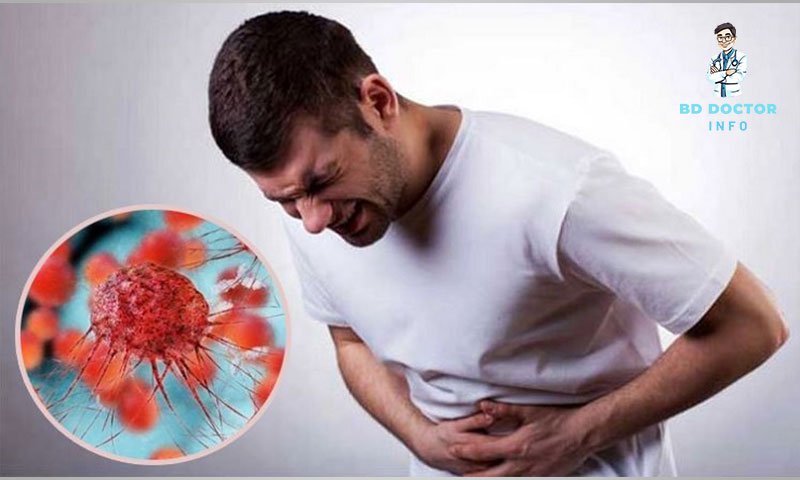 ঢাকার সেরা ক্যান্সার বিশেষজ্ঞ